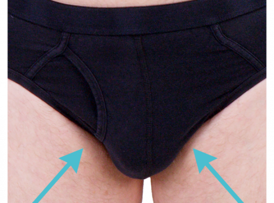 Close-up of a person wearing black briefs with two blue arrows pointing towards the central area.